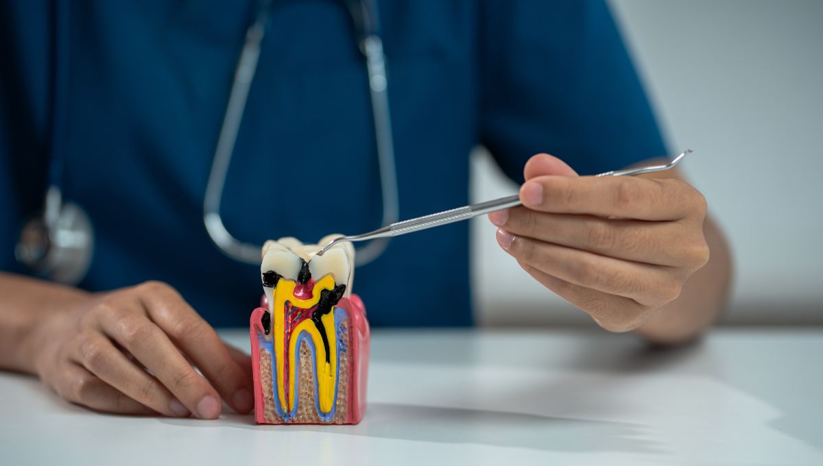 Root Canal Treatment Seattle