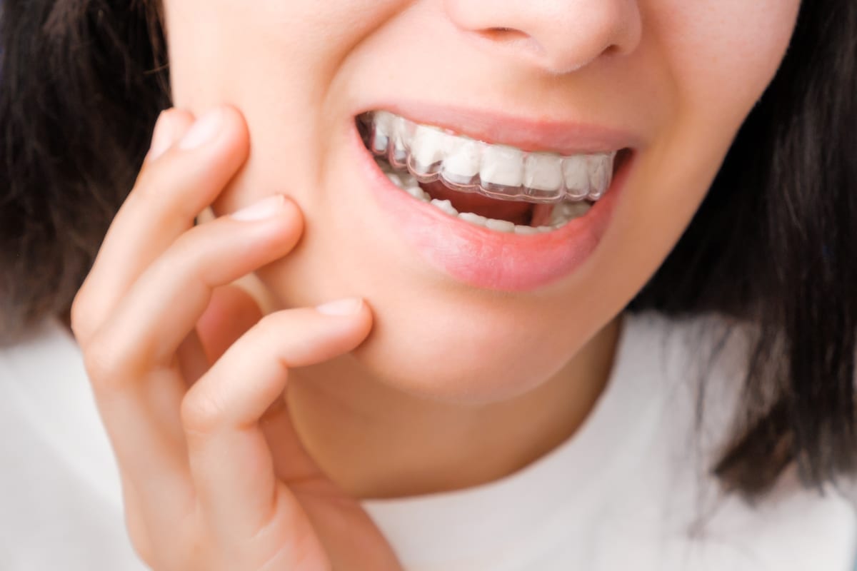 Clear Aligners in White Center