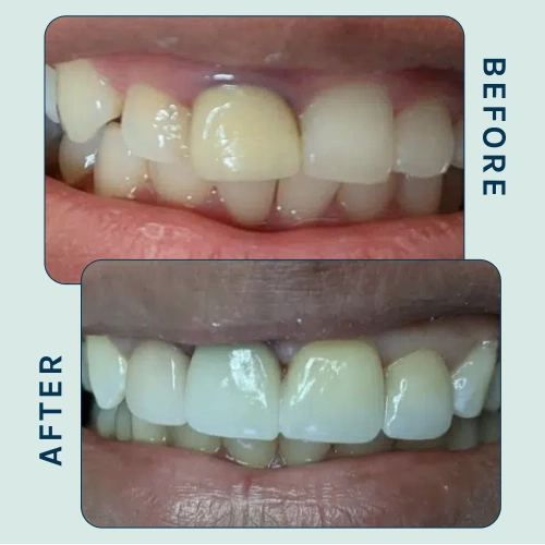 Cosmetic Dental-Treatment