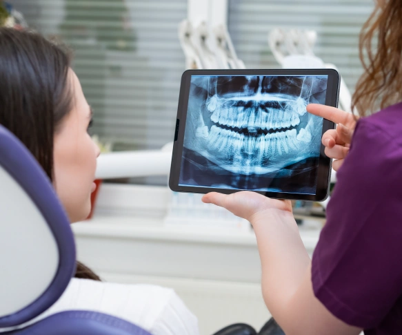 What Are Dental X-Rays?