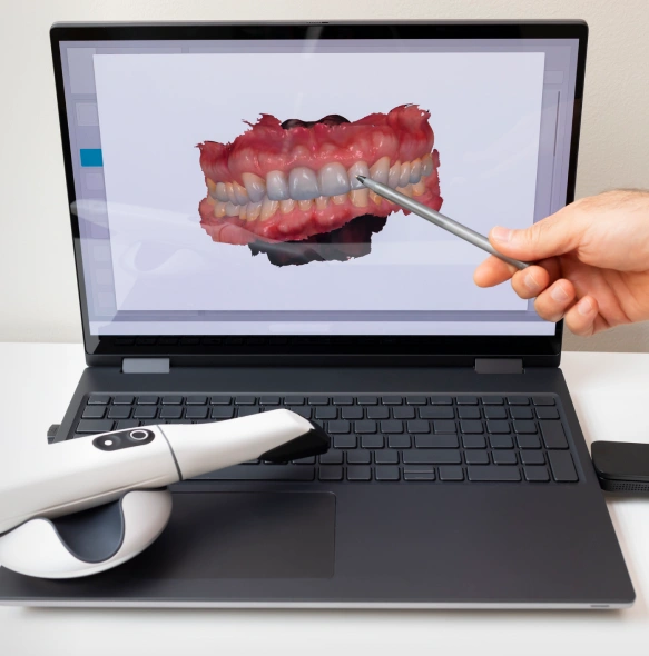 What Is Digital Scanning?