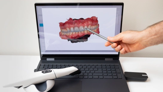 3D Digital Scanning