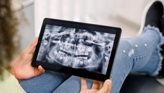 Technology Digital X-Rays