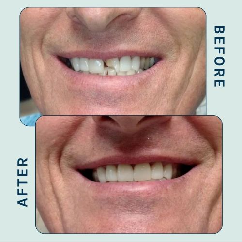 Cosmetic Dentistry